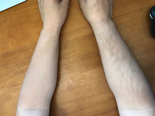 彻底去除毛根的脱毛膏,快速除毛膏有用吗