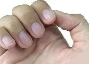 怎么从指甲上看健康图解,从指甲看疾病的图片说明