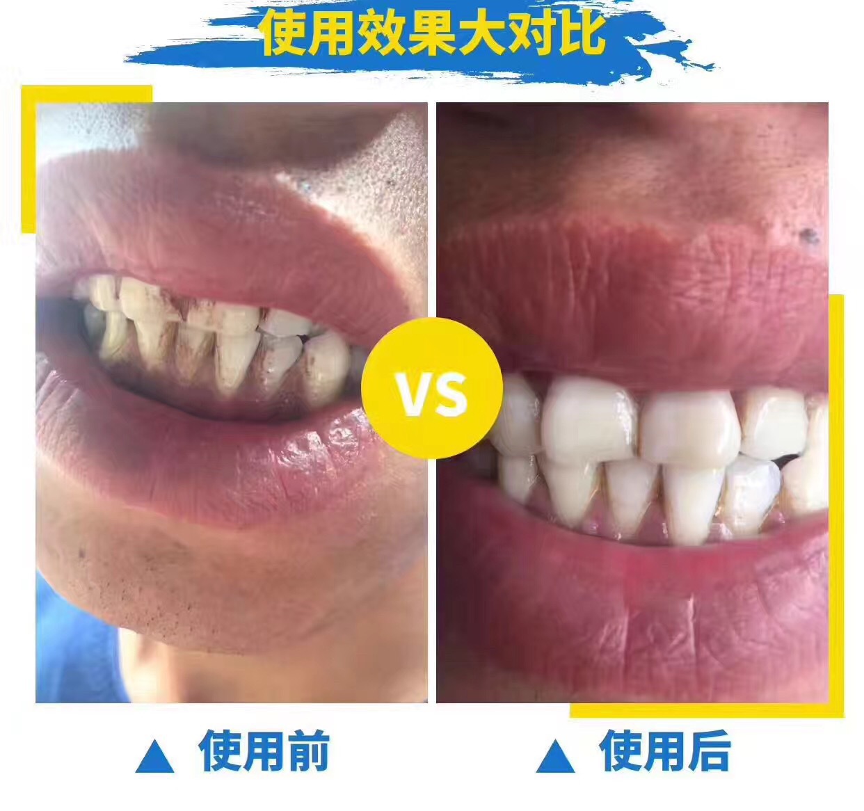 牙齿美白速效去黄牙烟渍神器,清洁牙渍美白牙齿