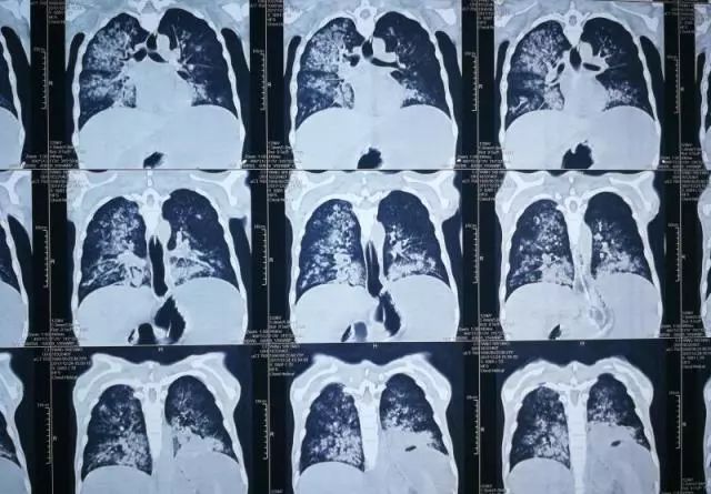 27岁清华医生脑死亡捐器官救5人,27岁清华医生脑死亡捐献器官救5人