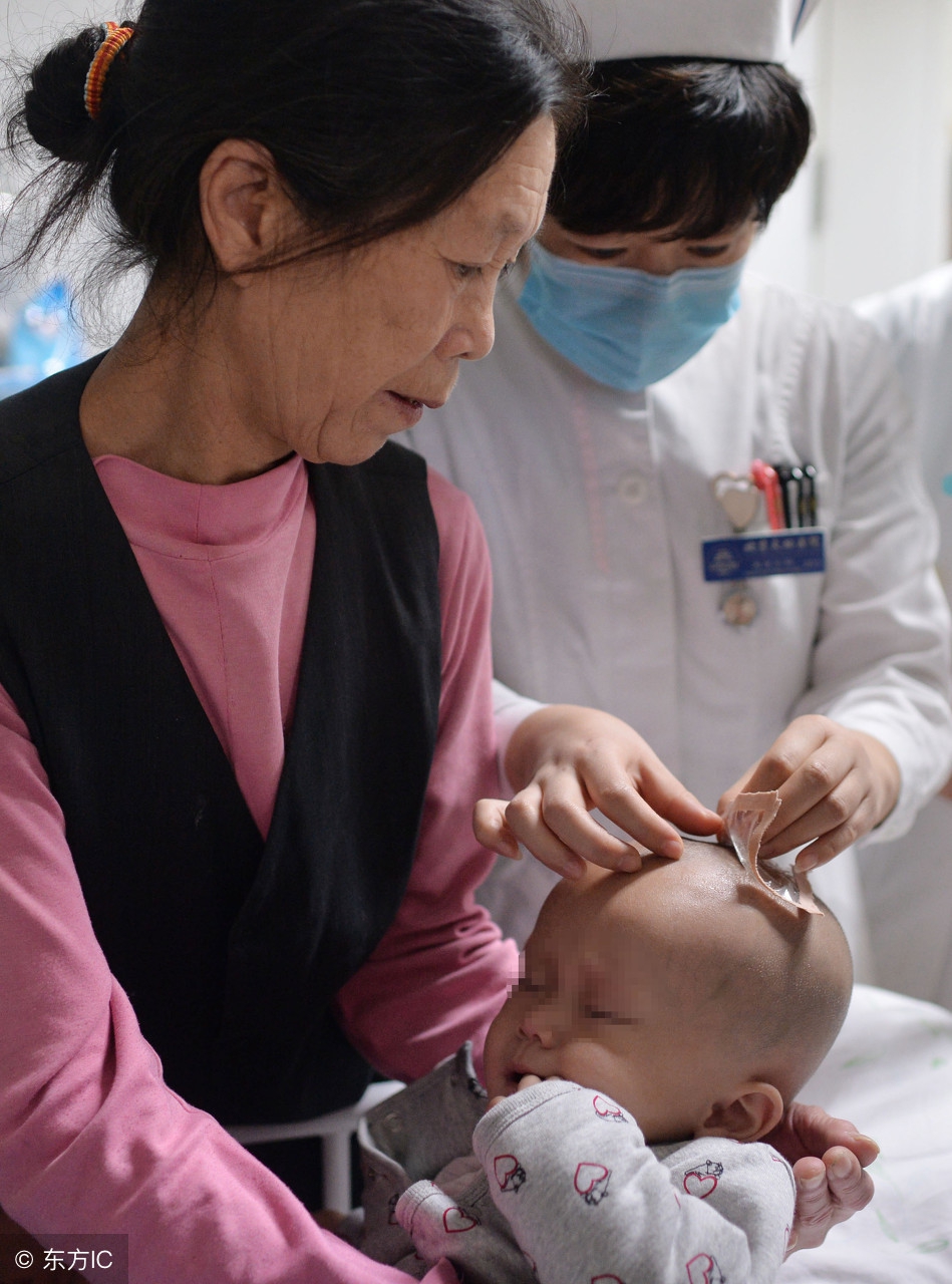 脑积水脱水疗法和全身疗法,脑积水引起的癫痫抽搐能活多久