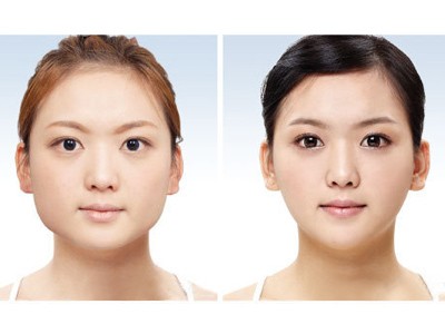 咬肌大显脸大咬肌大怎么瘦脸,瘦咬肌方法很重要方脸秒变小v脸