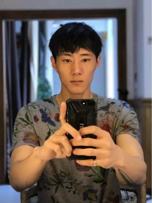 高晓松烟疤,高晓松烫烟疤