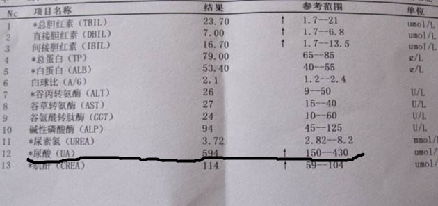 痛风高尿酸血症患者饮食注意事项,高尿酸痛风应注意哪些饮食