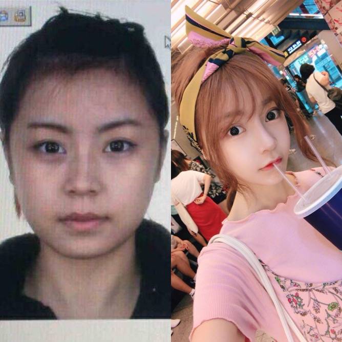 天津整形医院哪家是正规医院,整形医院最有口碑是哪几家