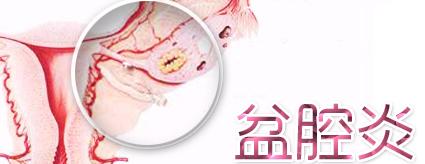 盆腔炎小便疼痛是怎么回事,盆腔炎老是想大便怎么回事