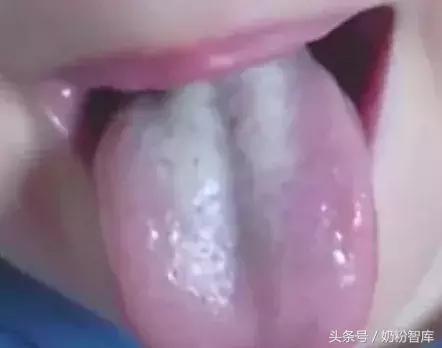 宝宝舌苔又厚又白还有红点,2岁宝宝舌苔白厚积食了怎么办