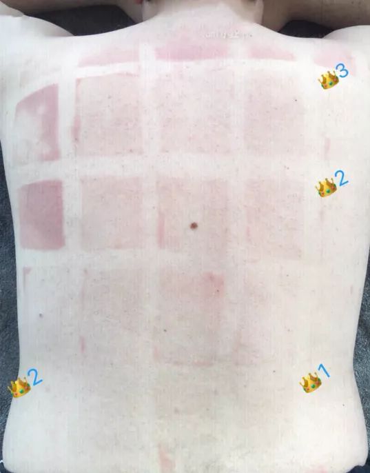 小哥暴晒3小时测防晒霜,小哥测试15款防晒霜