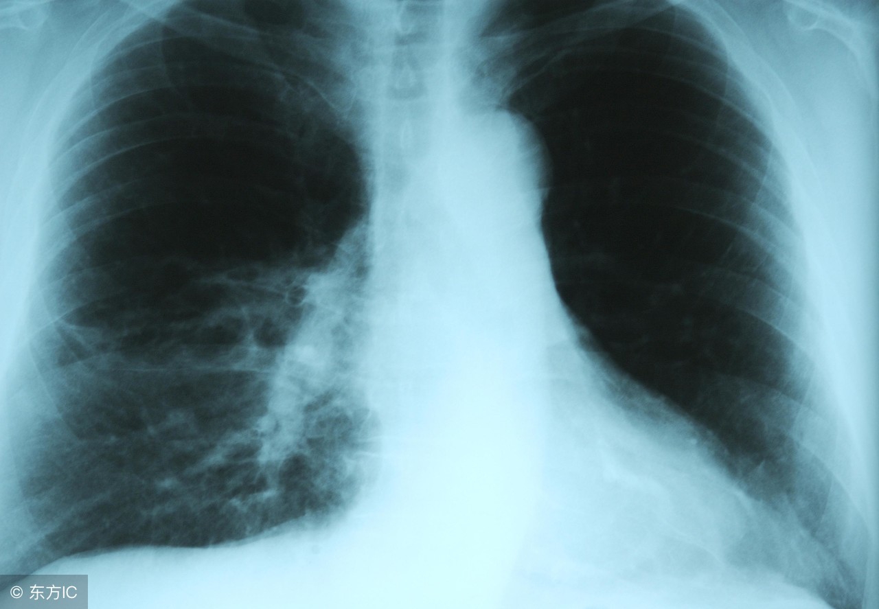 如何鉴定宝宝是否得了肺炎，预防肺炎如何来调养