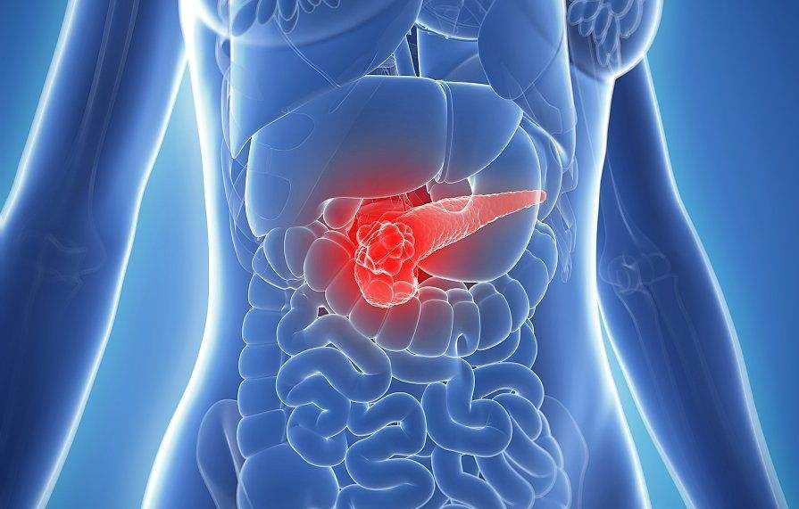 从炎症到癌症的三种病,慢性炎症与癌症的关系