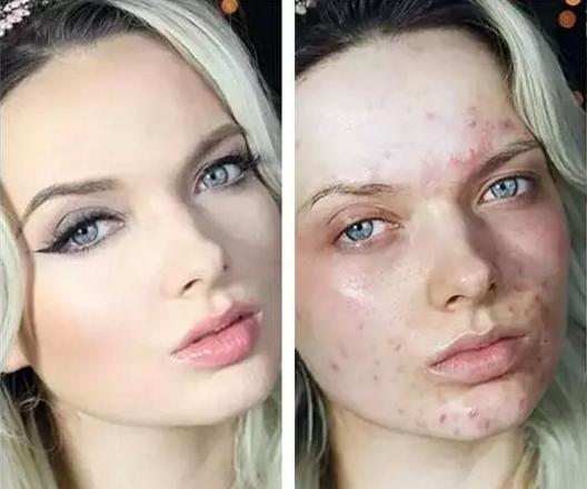 遮瑕种草黑眼圈,遮瑕泪沟种草