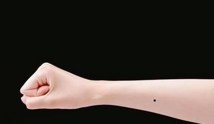 手心痣代表的器官,手心痣相图解男