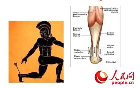 运动中的“阿喀琉斯之殇”：如何预防跟腱受伤？
