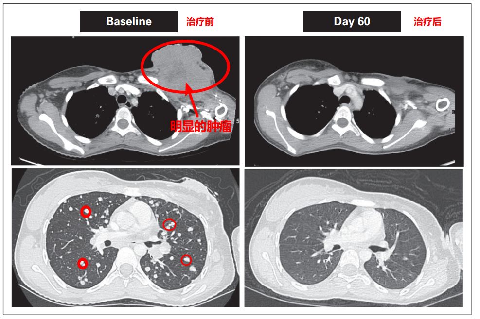 神奇制药抗癌药取得突破,神奇制药抗癌专利