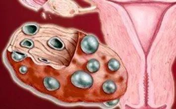 孕酮低于几nmol不建议保胎,孕酮不算低是什么意思