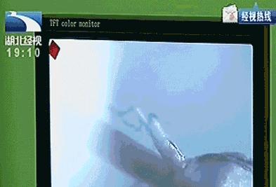 复旦精子库招募志愿者，补助5000块，但这个要求很多人不达标！