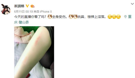 从性感女神到乡下小妹，张琪格开启户外直播变形记，网友：不容易