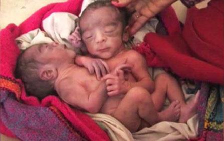 生两个女儿很开心,生两个孩子是希望他们互相陪伴