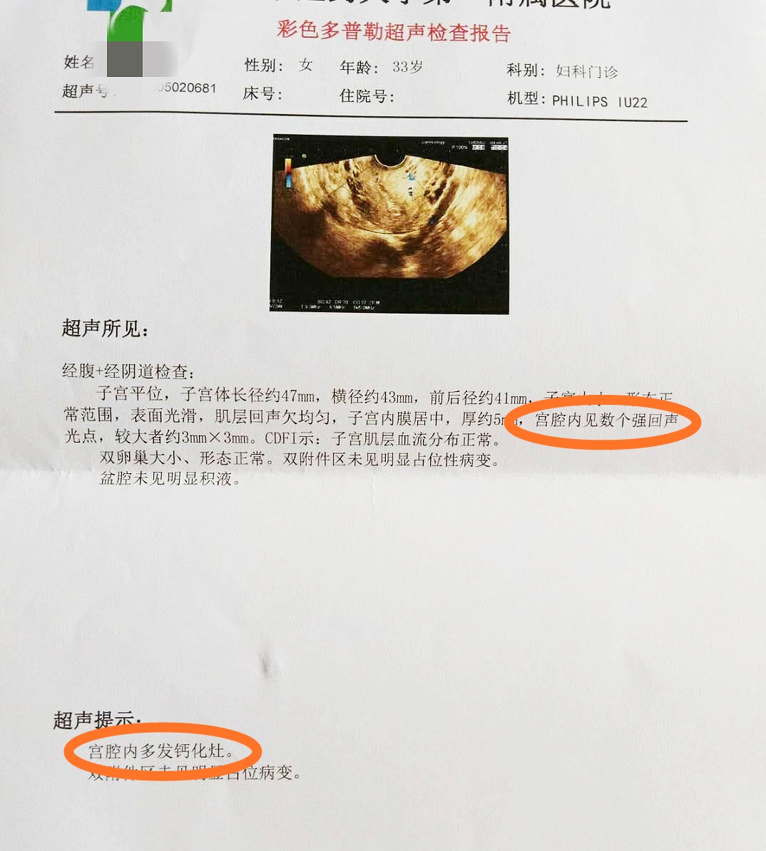 你的子宫在哪个位置是正常的,子宫里面淤血怎么更快排干净
