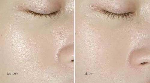 洁面吸油神器,电动洗脸神器清洁毛孔