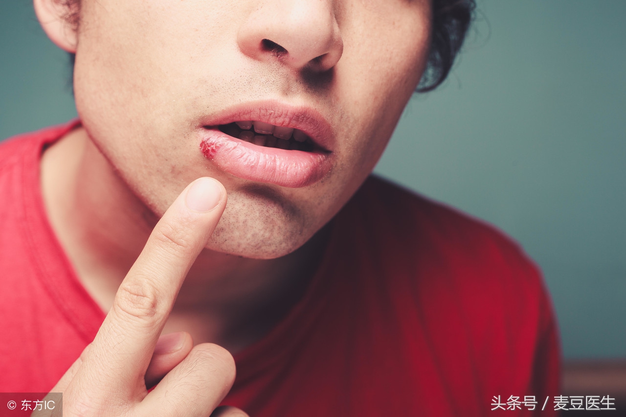 口腔溃疡疼痛严重怎么办最快愈合,口腔溃疡疼最快解决方法