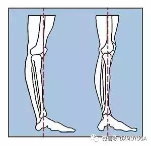 瑜伽拉伸体式练习，纠正膝盖超伸