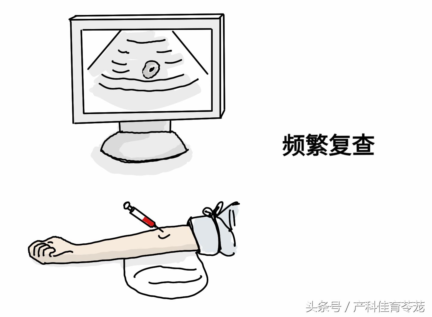 怀孕b超说有血流信号,怀孕了b超显示有积液好吗