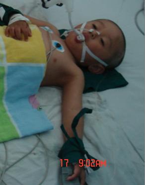 中医治疗手足口病最佳方法,中医辨证手足口病