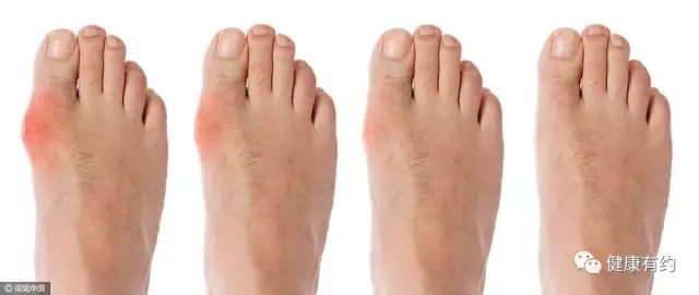 女子突然中毒怎么办,女子突然昏迷送医查出凶险病症