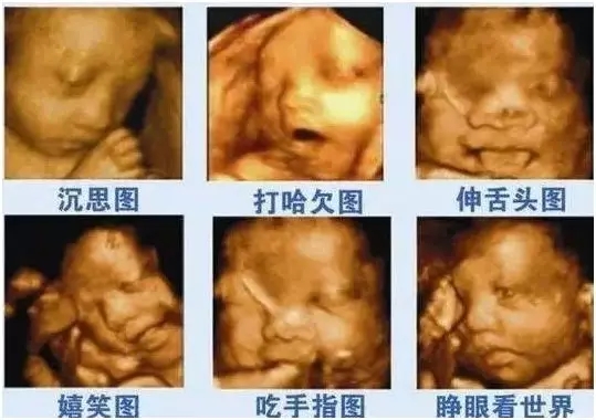 四维彩超有必要做吗,四维彩超刻盘有必要吗