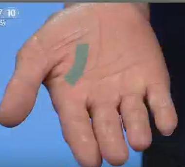 手是健康的镜子,手的健康识别