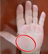 手的健康识别,手型看健康