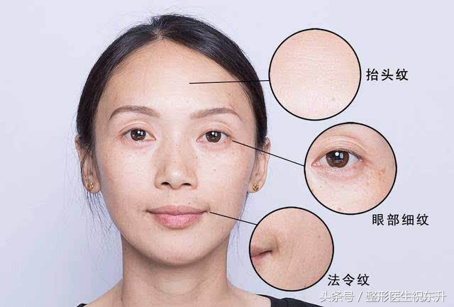 脸部肌肉下垂怎样变得紧致医美,脸部肌肉下垂怎么办