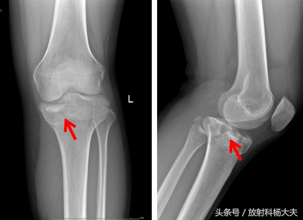 看了这些图，才知道，其实足球是比较*力暴**的运动