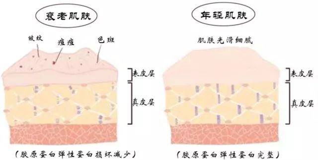 不打针就能有效去皱纹的产品,不用打针就能去皱的产品