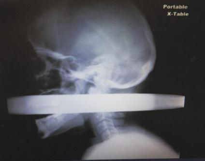 阴茎纹身还有这用处？医生应该见识的22个奇葩病例