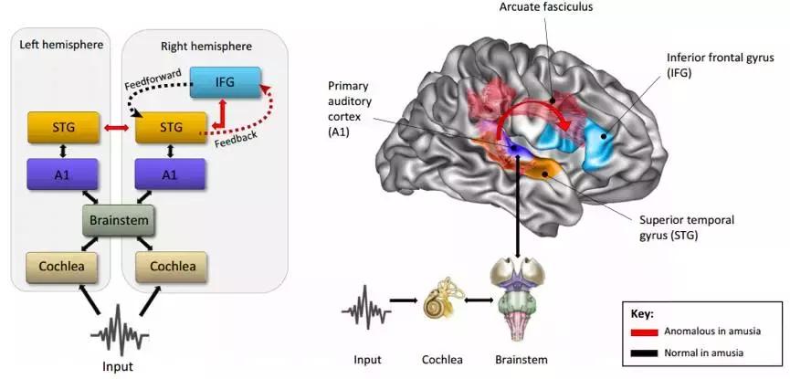 唱歌跑调居然真的是一种病,唱歌跑调还能当歌手么
