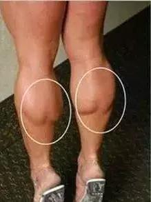 什么样的肌肉腿才好看,粗腿都有什么腿型