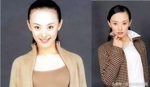 额头凸出有点像寿星公命运,额头饱满像寿星公好吗