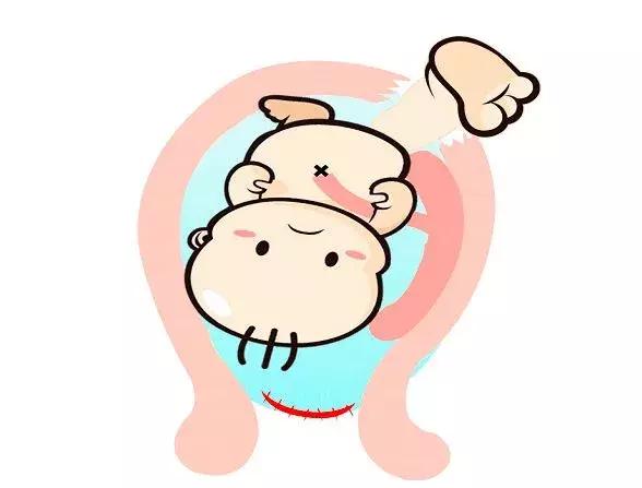 月经十天没干净可能是子宫憩室，有剖宫产史者要注意！