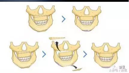 35岁杨幂与34岁赵丽颖谁更美,颜值大比拼赵丽颖杨幂