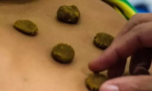 酷暑治“冬病”，省中约您一起趁热把那事儿给办了