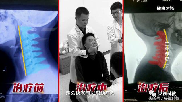 中医正骨治疗腰疼视频,腰疼最快缓解方法躺床上正骨