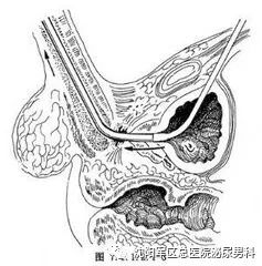 周一专家号（第69期）-尿道修复、修前必读