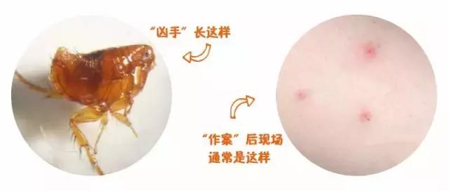 宝宝被蚊虫叮咬最好的解决办法,宝宝被蚊虫叮咬后有什么好办法吗