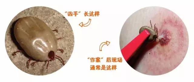 宝宝被蚊虫叮咬最好的解决办法,宝宝被蚊虫叮咬后有什么好办法吗