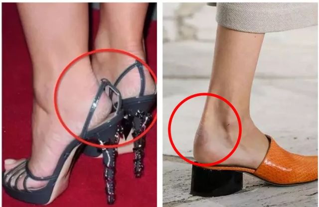 擦掉一张皮，双脚换皮术！死皮、老茧一喷就没，15秒还原嫩白玉足！