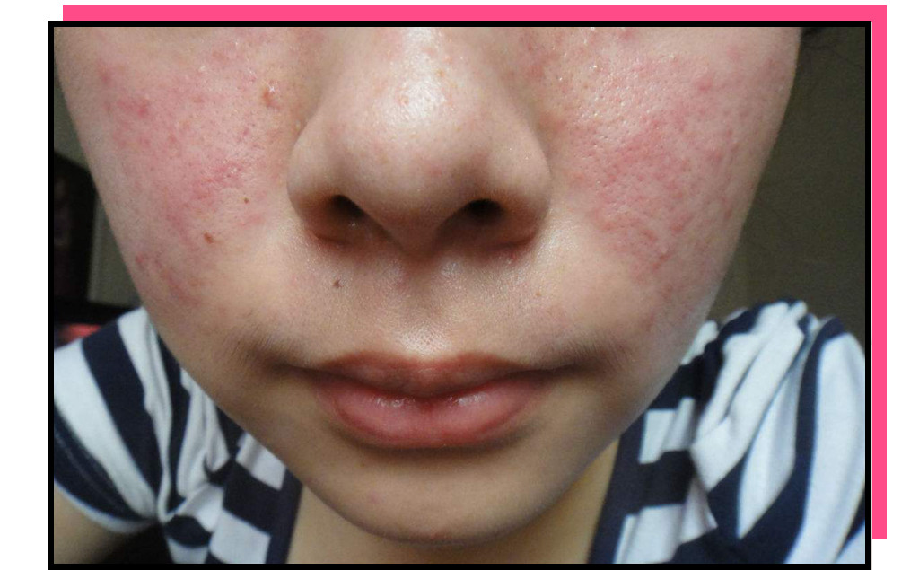 日本十大网红药妆,日本药妆品牌销量排名