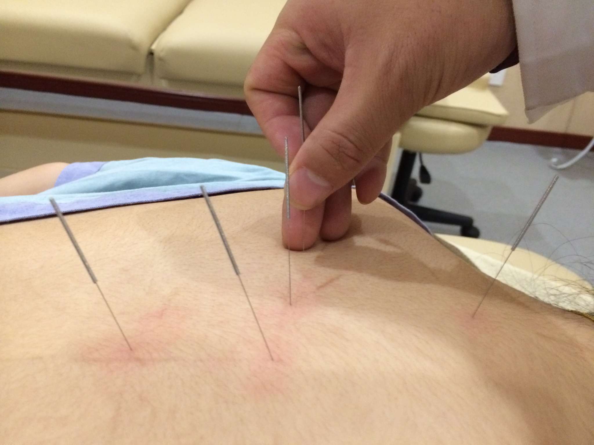 中医治疗晚期肝癌100例,了不起的中医治疗肝癌