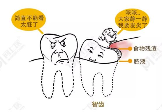 智齿为啥叫恒牙,智齿为什么叫阻生